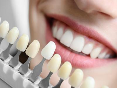 &Auml;sthetische Zahnheilkunde